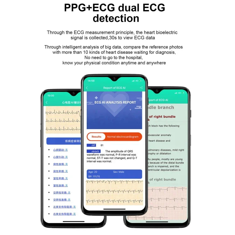 E86 1.7 吋 TFT 彩色螢幕 IP68 防水智慧手錶，支援血氧監測／體溫監測／AI 醫療診斷，款式：鋼錶帶，鋼錶帶（黑色）