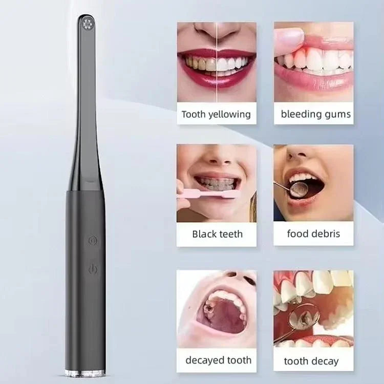 FY-B800 視覺口腔觀察儀 無線 WiFi 高清口腔內窺鏡