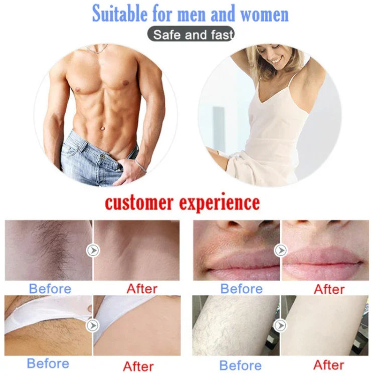 美容家用IPL無痛激光脫毛儀通用男女