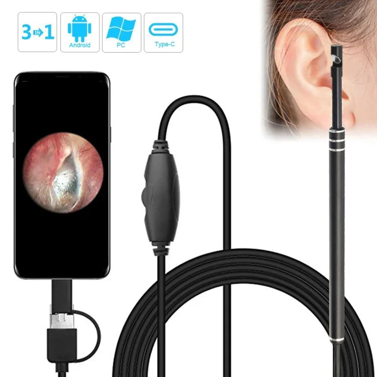 i96 3 合 1 USB 耳鏡檢查高清 0.3MP 攝像頭視覺耳勺，適用於 OTG 安卓手機、PC 和 MacBook，1.85 米長線，3 合 1 黑色 0.3MP