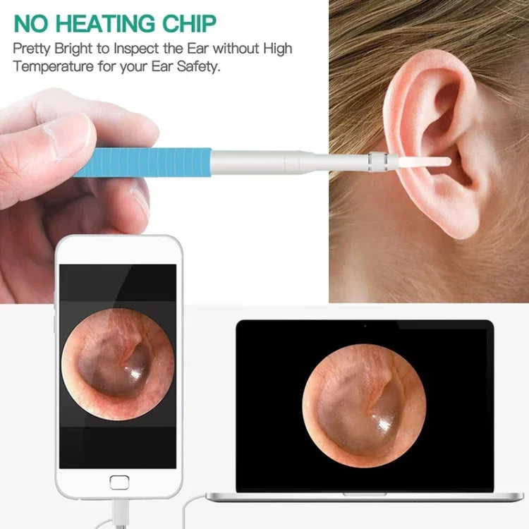 i95 3 in 1 USB Ear Scope Inspection HD 0.3MP Camera Visual Ear Spoon for OTG Android Phones & PC & MacBook, 1.75m Length Cable, 3 in 1 White  0.3MP