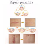 Organic silicone Gel Scar Therapy Patch  be Washed and Reused