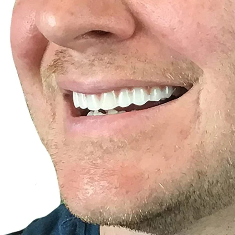 美容工具假牙即時微笑舒適貼合柔性假牙套